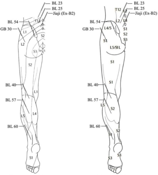 Acupuncture points in case of piriformis syndrome